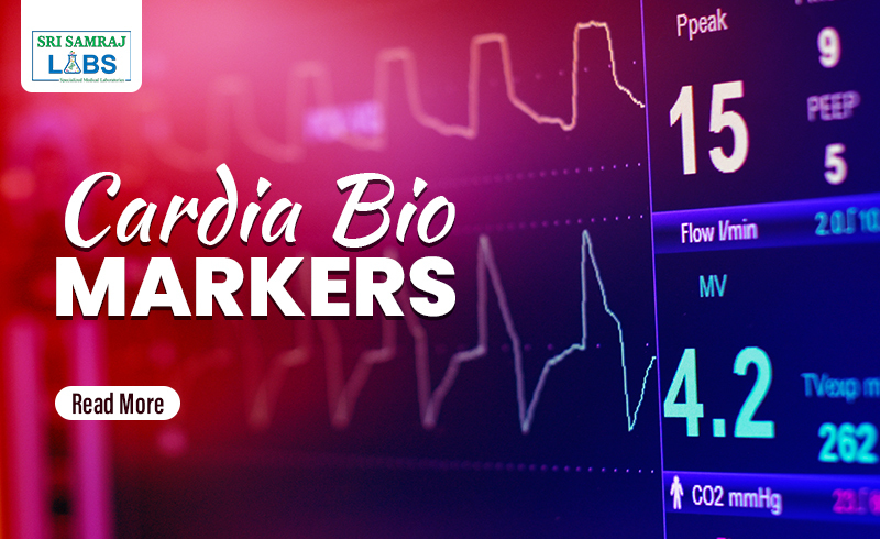 Samraj Blog Banner Cardiac Biomarkers